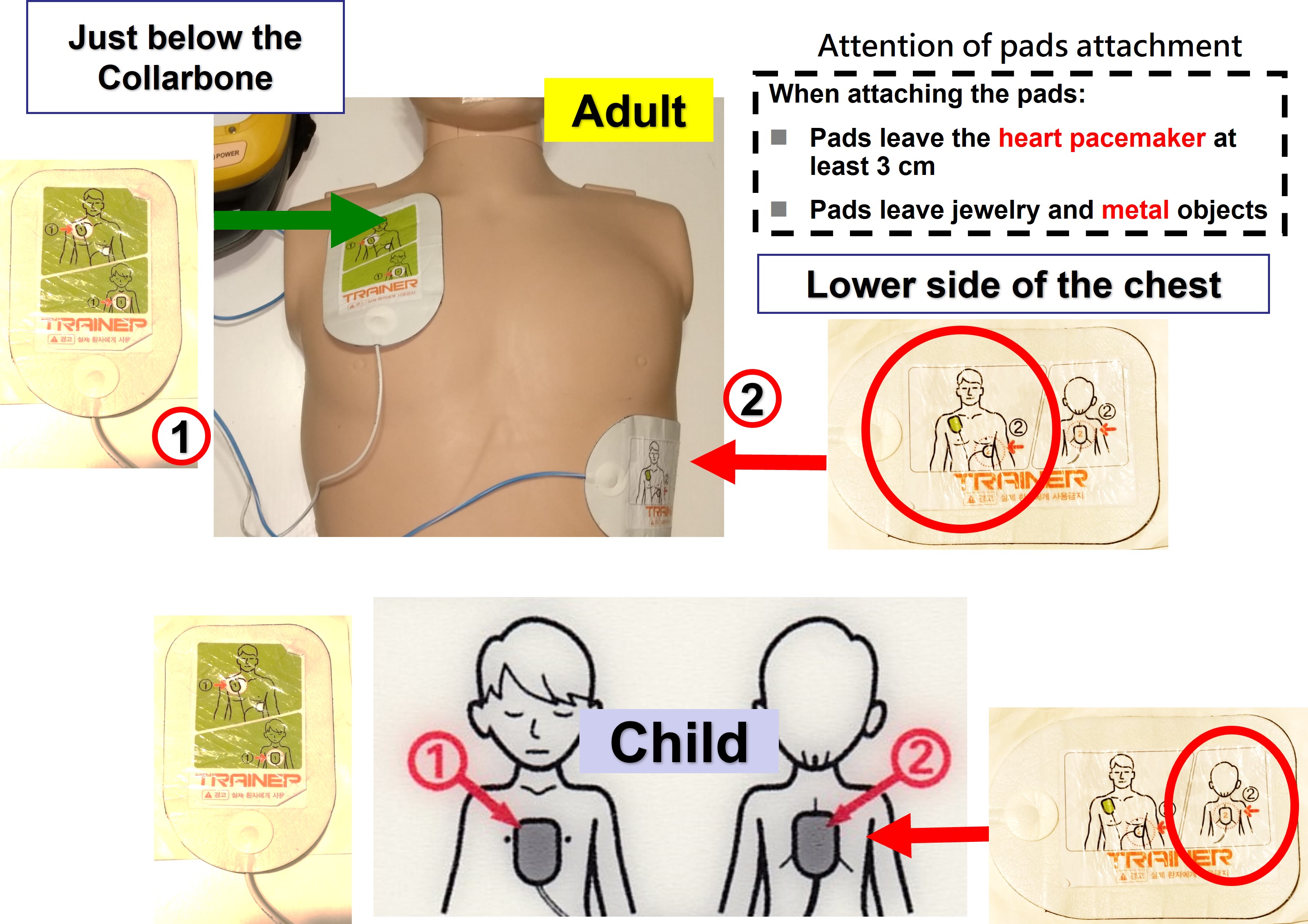 AED Pads attachment