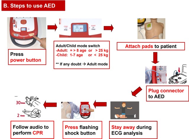 AED operation steps